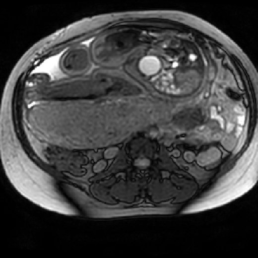 One axial slice of the source fetal MRI.